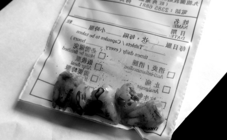 智慧齒拔牙記2016。一口氣拔四隻!!!